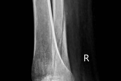 187786242_308624997661586_6176810939914851591_n_18144819748167929